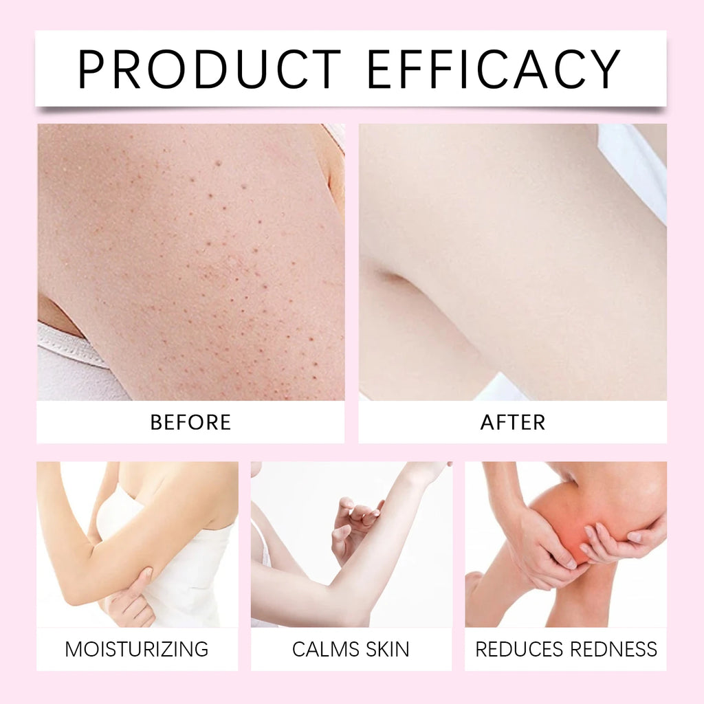Hair Removal Essential Oil - Smooth Skin and Ingrown Hair Care
