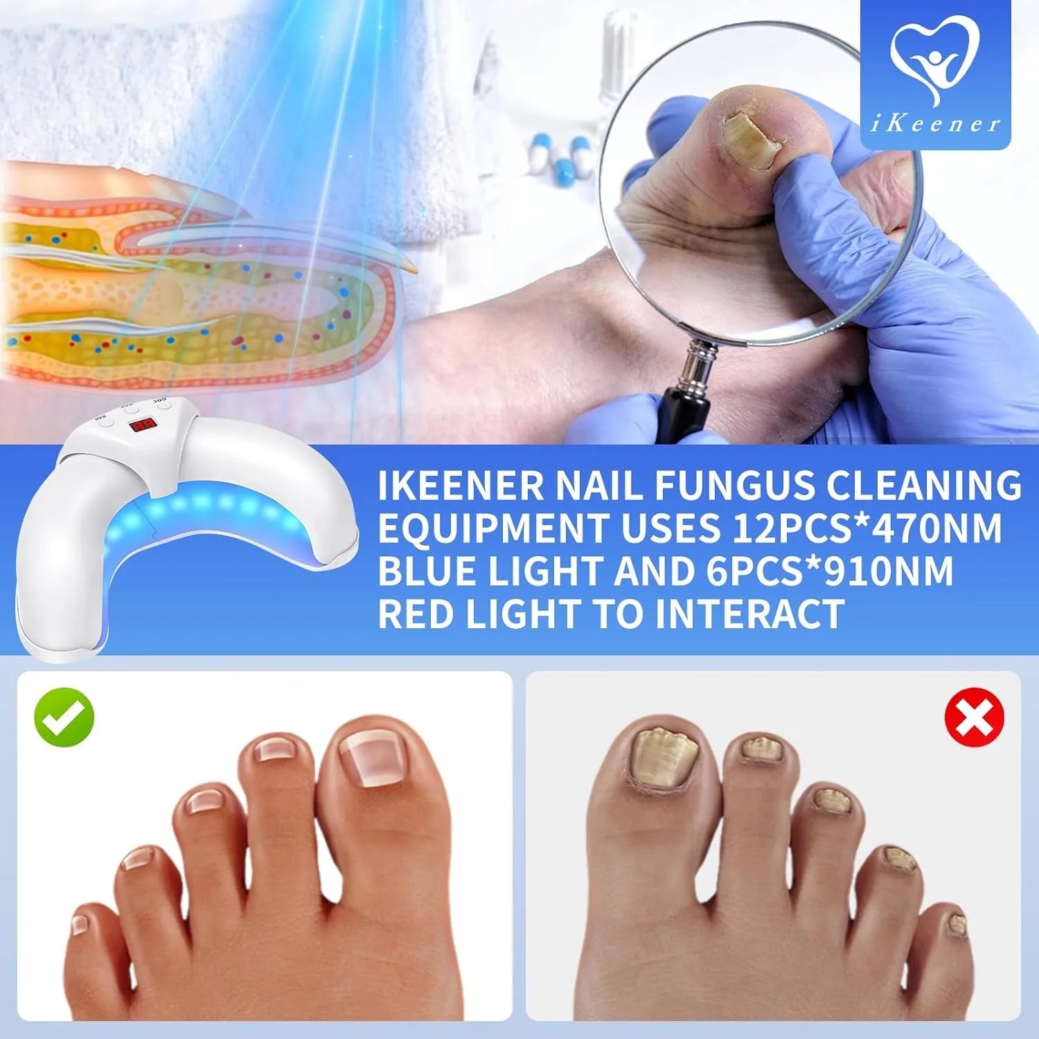 💕 Advanced Nail Care Light Therapy Device - Easy Home Use